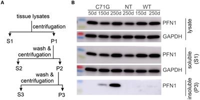 Detergent-insoluble PFN1 inoculation expedites disease onset and progression in PFN1 transgenic rats